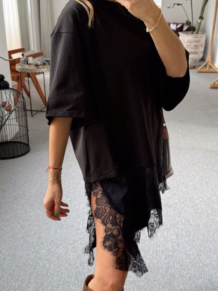 SİYAH DANTEL DETAY TUNİK BLUZ
